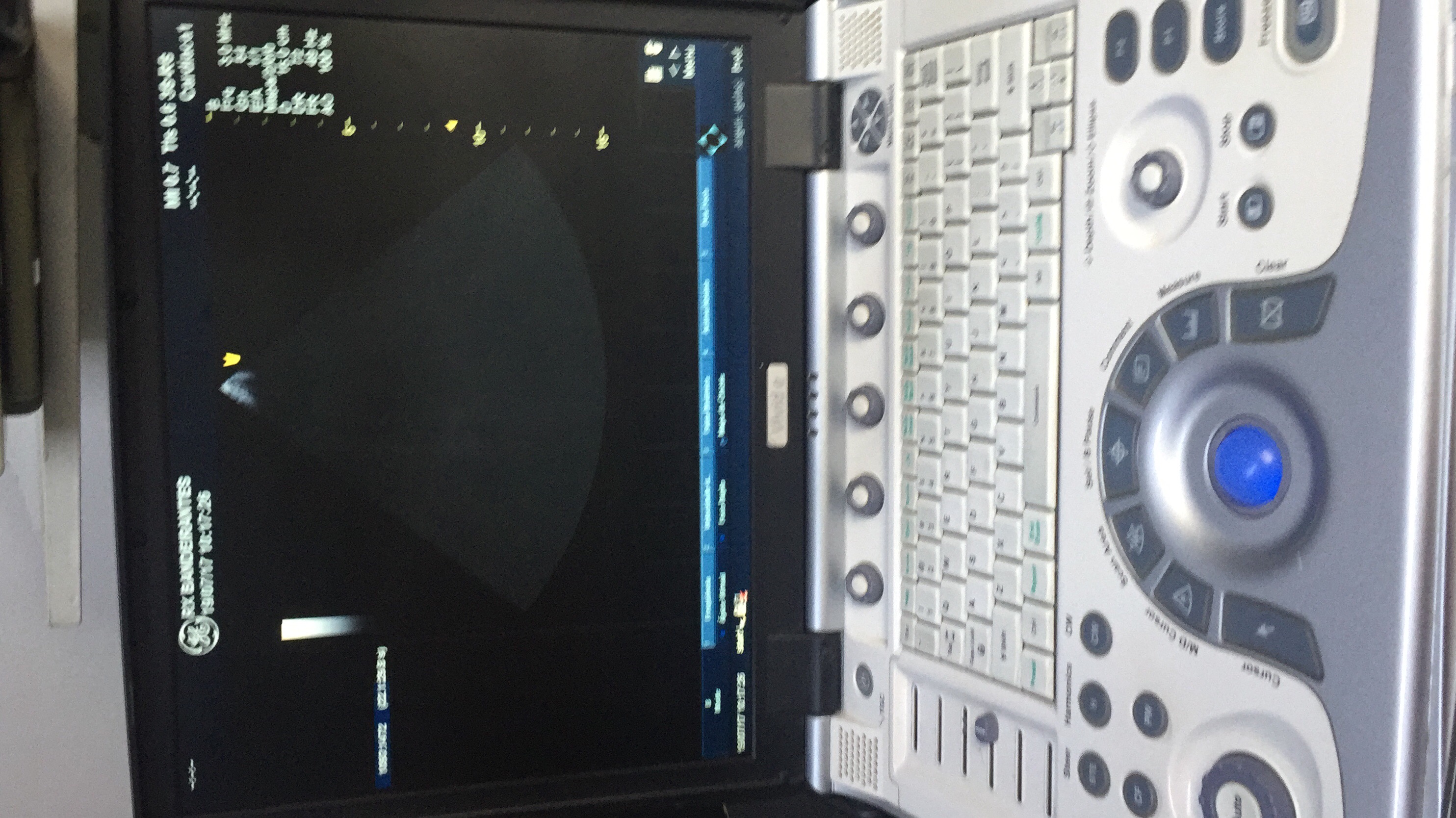 Ultrassom