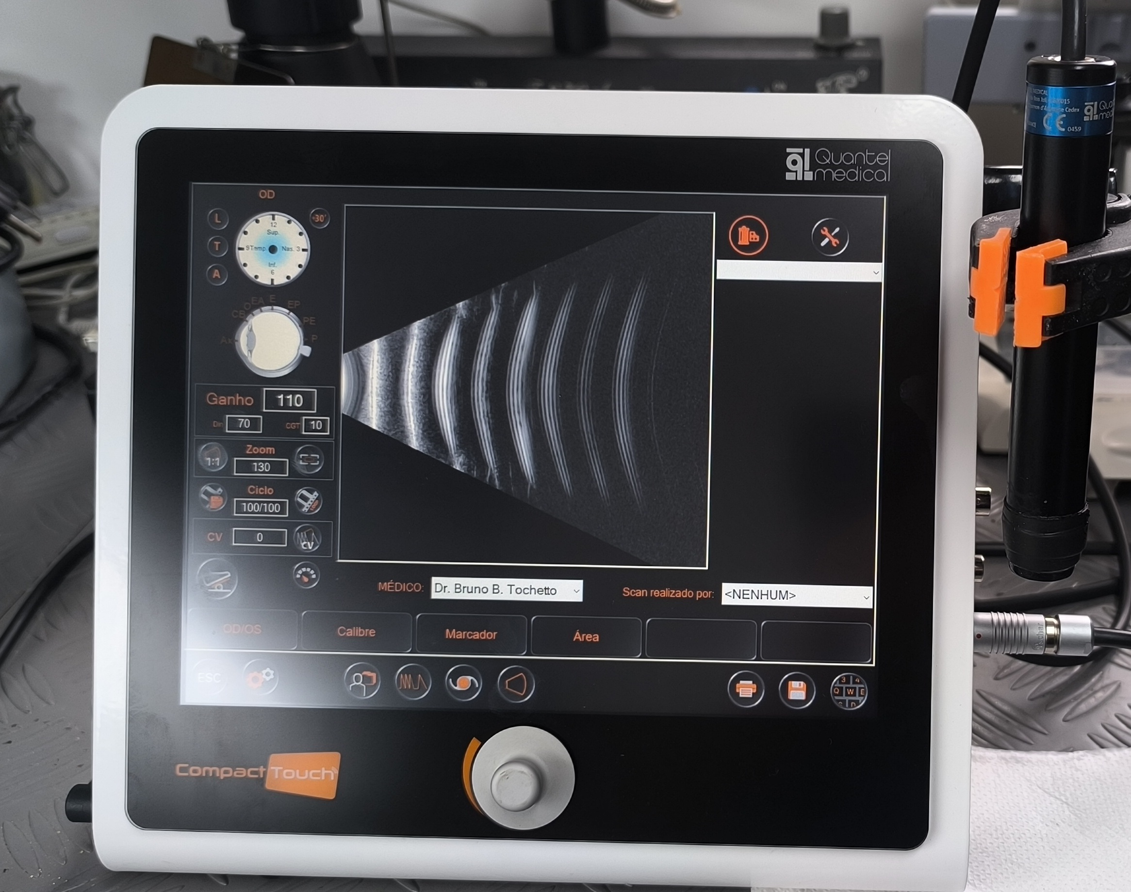 Ultrassom Oftalmológico