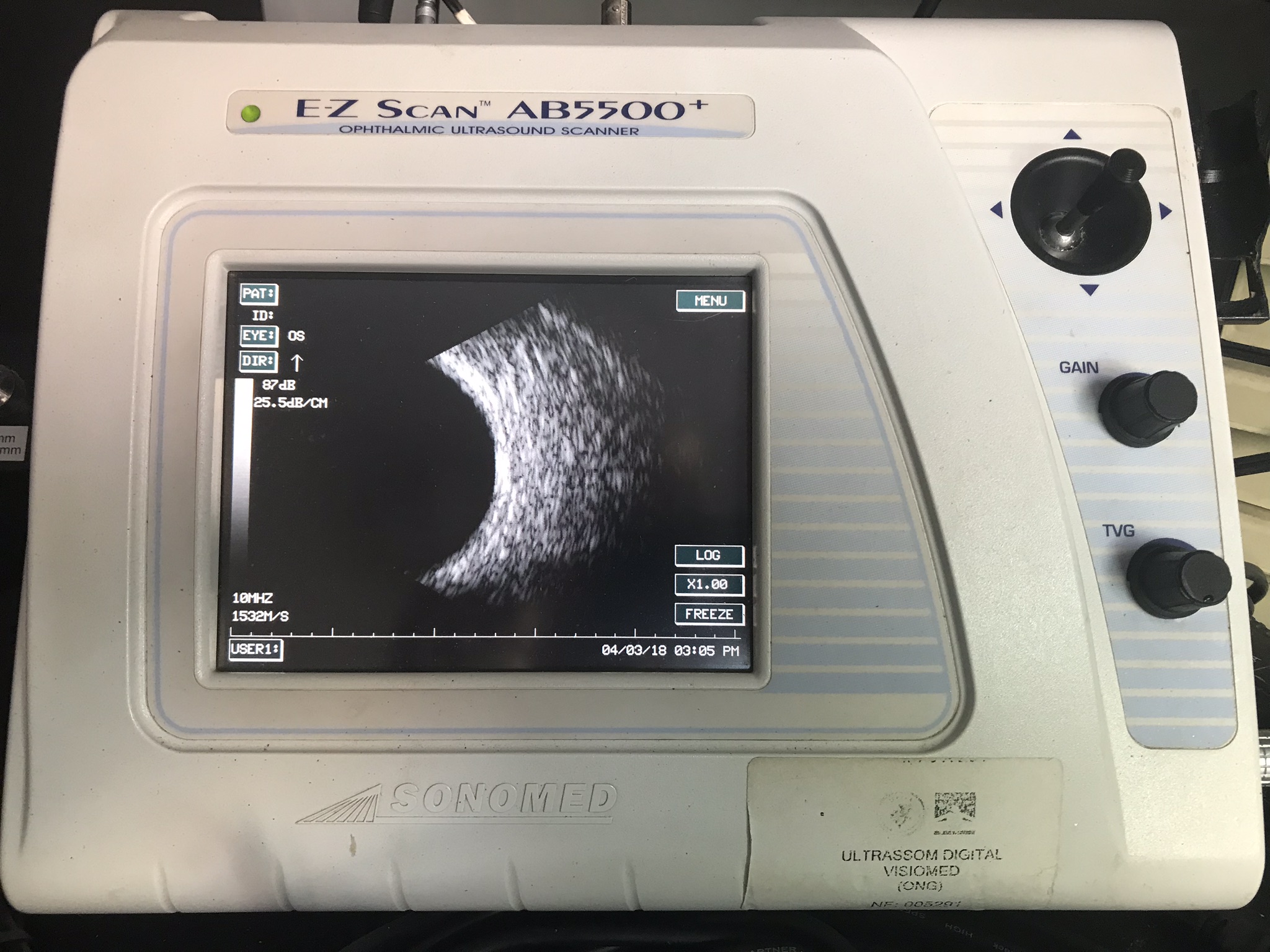 Ultrassom Oftalmológico